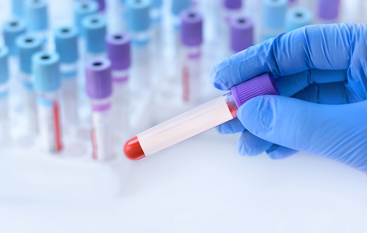 DOT Drug Testing: What Every Employer and Driver Needs to Know